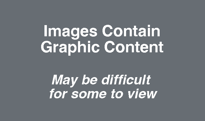 Caution Graphic Content